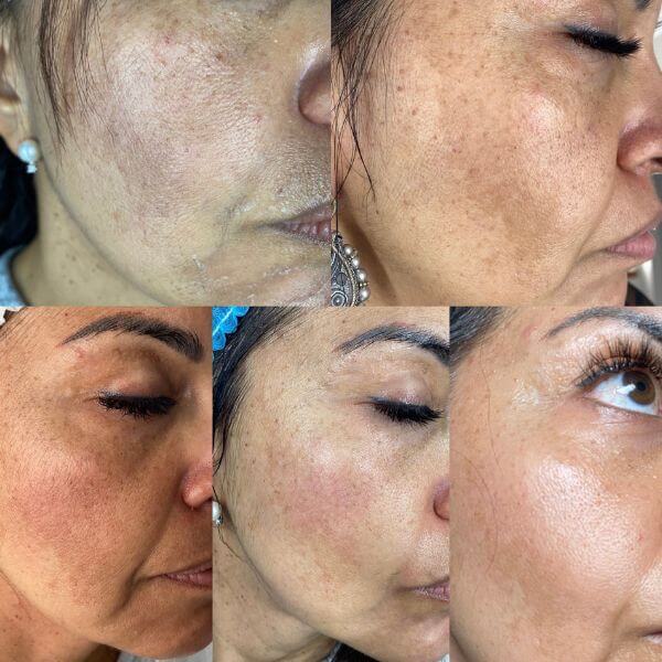 Luisa Sánchez - Beauty Studio | Microblading | Eyeliner | Labbra PMU | Nails | Ciglia | Tatuaggio Areola Mammaria