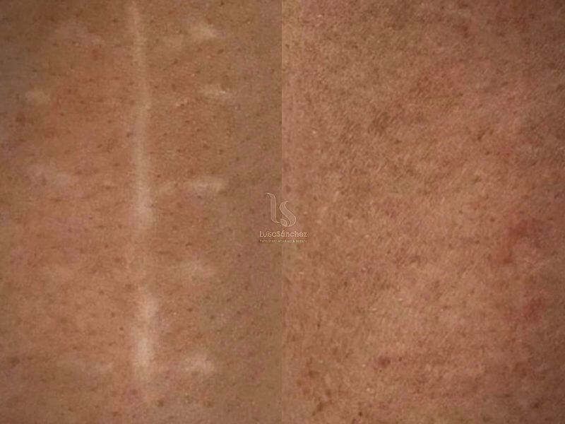 Luisa Sánchez - Beauty Studio | Microblading | Eyeliner | Labbra PMU | Nails | Ciglia | Tatuaggio Areola Mammaria