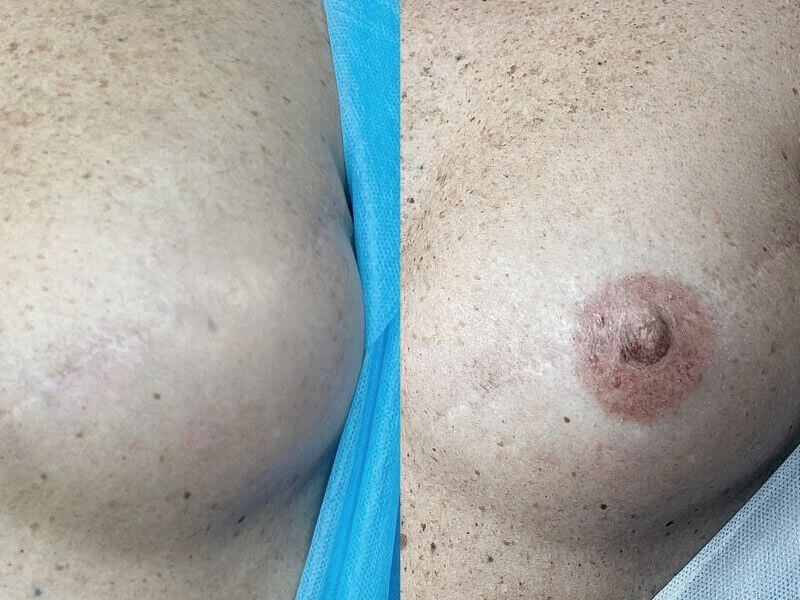 Luisa Sánchez - Beauty Studio | Microblading | Eyeliner | Labbra PMU | Nails | Ciglia | Tatuaggio Areola Mammaria